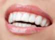 how much are braces, how much does braces cost, orthodontic treatment, orthodontic braces, orthodontic services, southern illinois orthodontist, orthodontist carbondale il, orthodontist marion il, orthodontist carterville il, orthodontist Herrin, orthodontist murphysboro, orthodontist giant city, orthodontist johnston city, orthodontist goreville, braces marion il, braces carbondale il, braces cost,